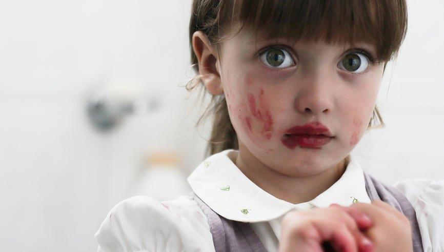 Dermatoloq xəbərdarlıq edir: Bu vasitələr uşaqlar üçün risklidir